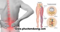 Cập nhật  điều trị Nội khoa: Đau thần kinh tọa